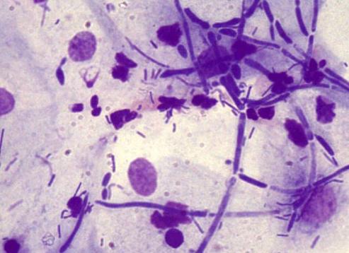 Флора палочковая в мазке у женщин что это