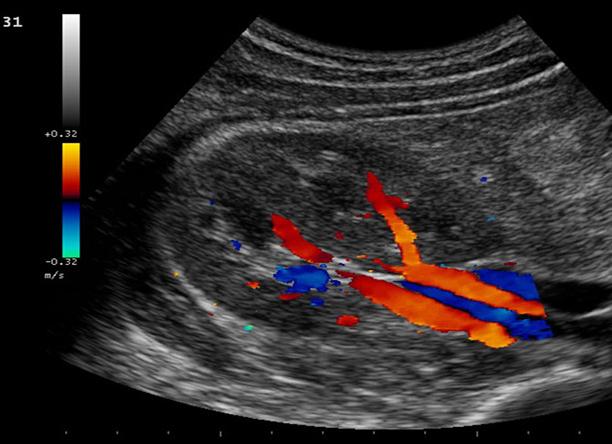 Что такое узи с доплером
