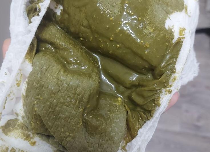 Черно зеленый кал у ребенка