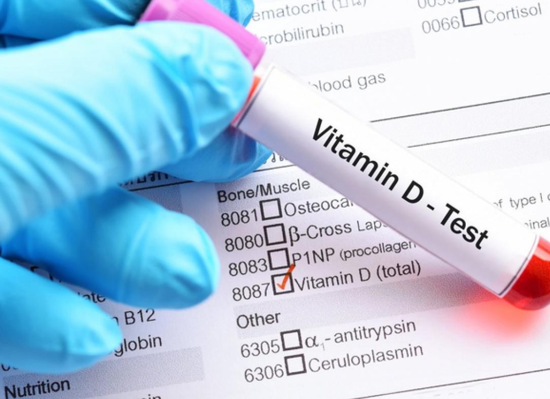 Анализ на витамин д