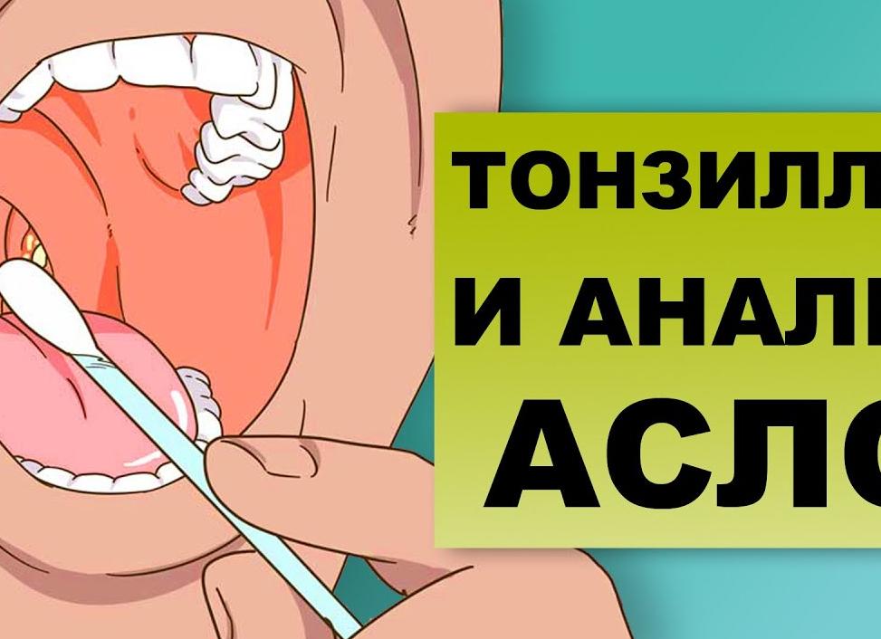 Анализ асло что это такое