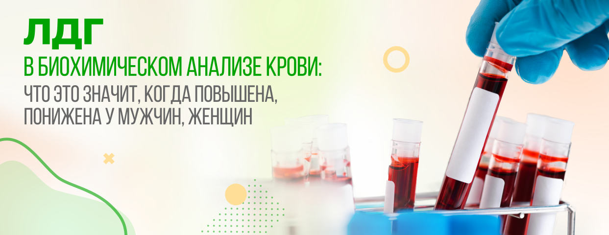Лдг в биохимическом анализе крови