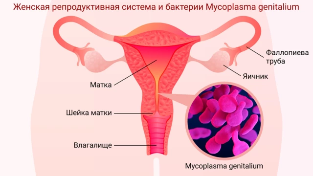 Микоплазма гениталиум это