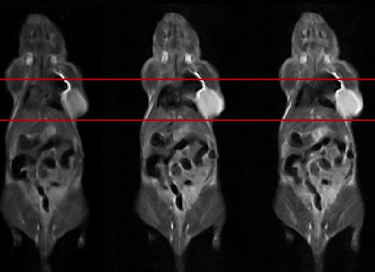 Мрт внутренних органов какие болезни можно обследовать