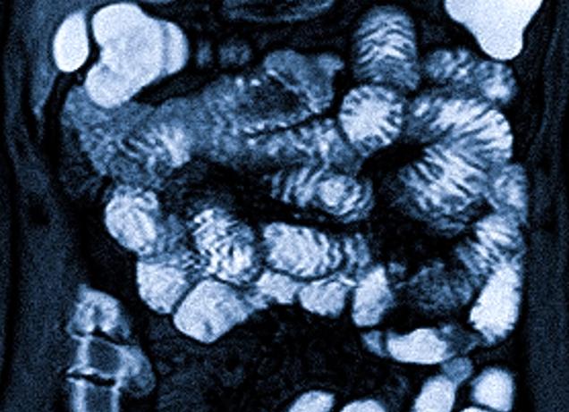 Мрт кишечника подготовка к исследованию