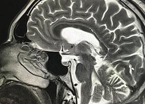 Мрт головного мозга опасно ли