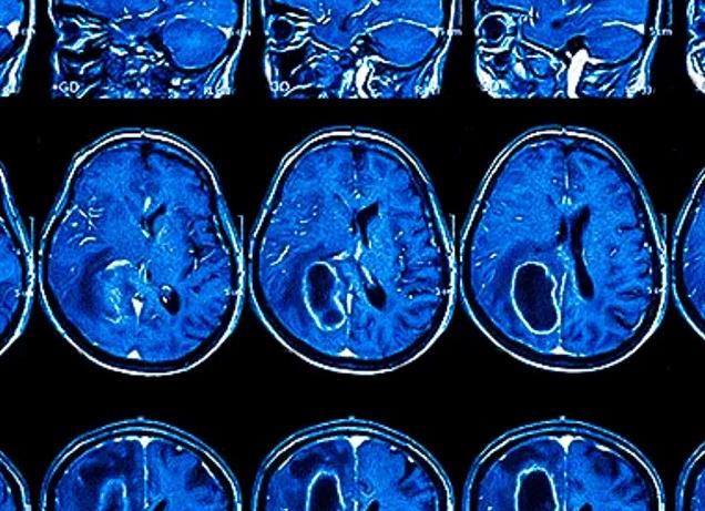 Ээг и рэг головного мозга