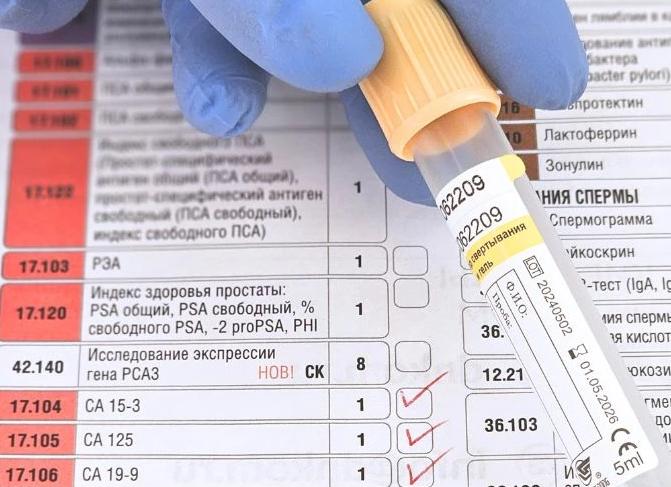 Что показывает онкомаркер анализ