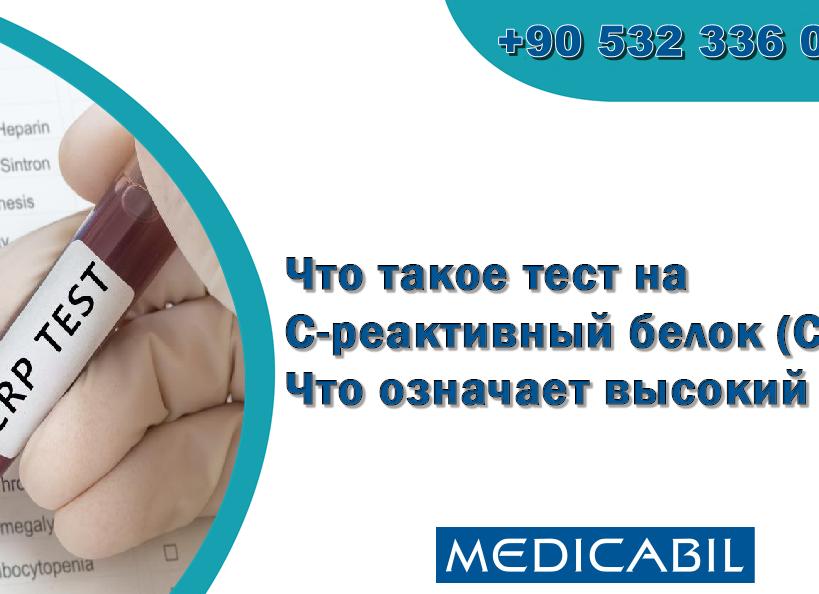 Что означает анализ