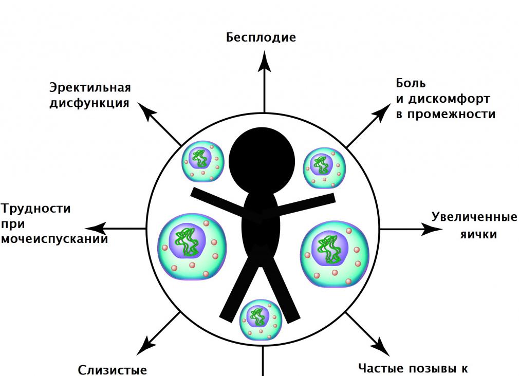 Чем лечить уреаплазму парвум у женщин Чем лечить уреаплазму парвум у женщин