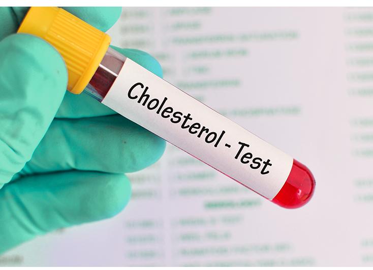 Анализы на холестерин расшифровка