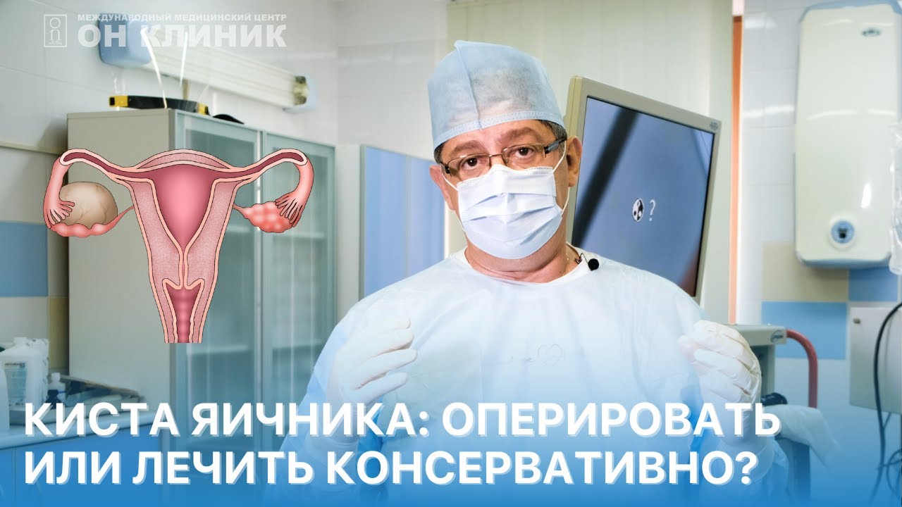 Как лечить кисту яичника эндометриоидную