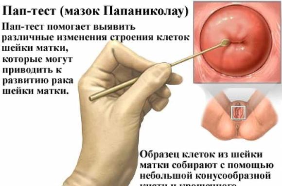 Мазок на цитологию что это