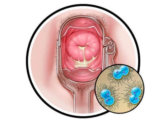 На какой день гонорея проявляется у мужчин