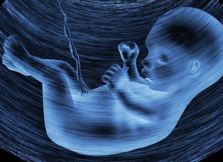 Может ли ошибаться узи с диагнозом