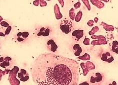 Гонококки в мазке у женщин что это