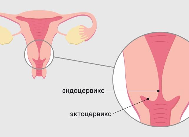 Эктоцервикс что это