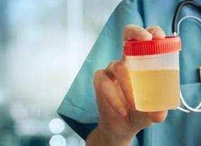 Анализ кала и мочи