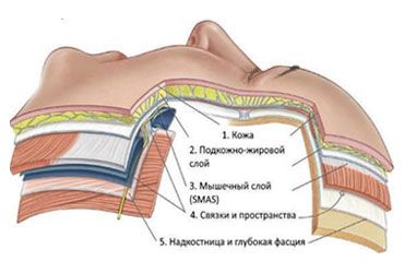 Мягкие ткани это