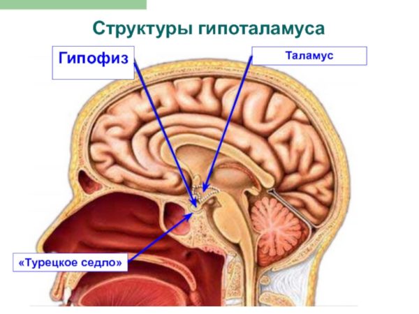 Мрт турецкое седло головного мозга