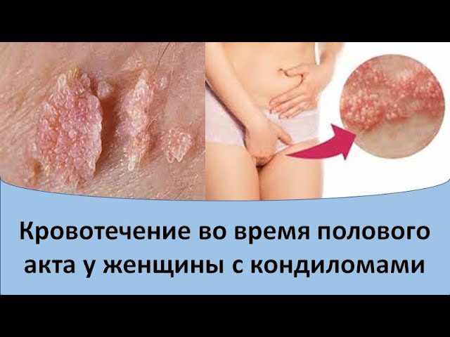 На какие инфекции нужно сдать анализы после незащищенного акта