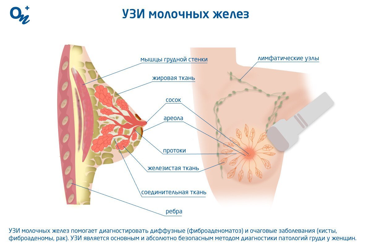 На какой день цикла делать узи молочных желез при мастопатии