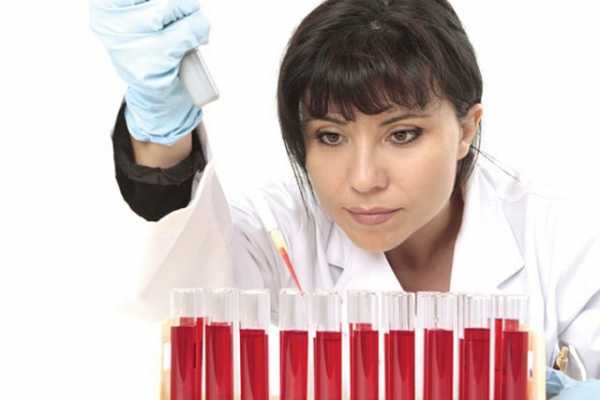 Анализ крови гемоглобин норма у женщин после 50 лет