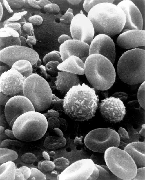 Анализ лейкоциты в крови расшифровка