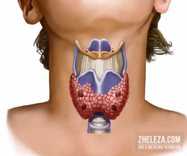 Анализ на гормоны щитовидной железы