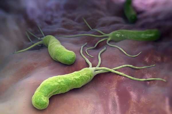 Бактерии хеликобактер причины возникновения