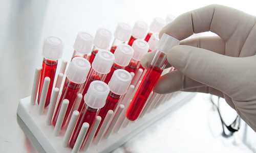 Что можно узнать по общему анализу крови