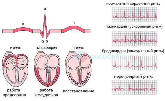 Что покажет экг сердца