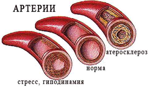 Что сгущает кровь