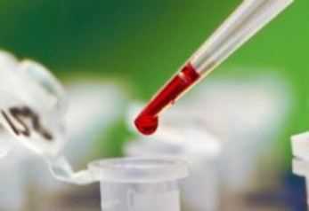 Что такое гематокрит в крови