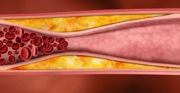 Что такое холестерин лпвп в биохимическом анализе крови