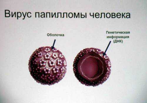 Что такое инфекция впч