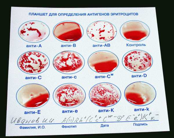 Как выглядит первая группа крови на планшете