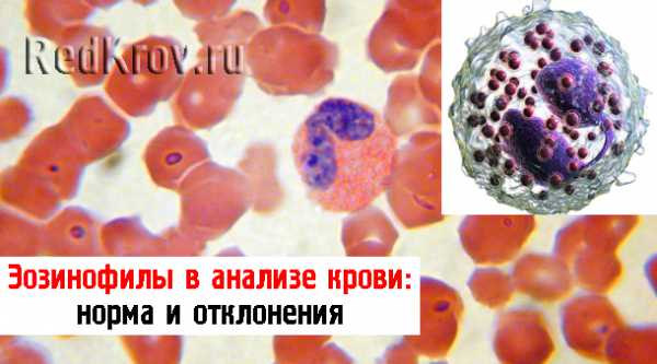 Эозинофилы повышены у мужчины в крови причины