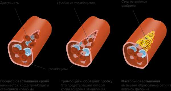 Диета перед кесаревым сечением