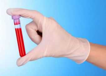 Как определить по общему анализу крови рак