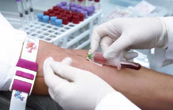 Как подготовиться к анализу на биохимию крови