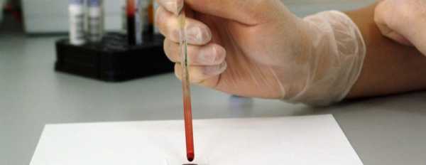 Как понизить гемоглобин в крови у мужчин народными средствами