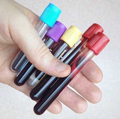 Как понизить уровень лейкоцитов в крови