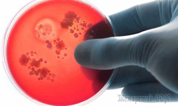 Как понять вирусная инфекция или бактериальная