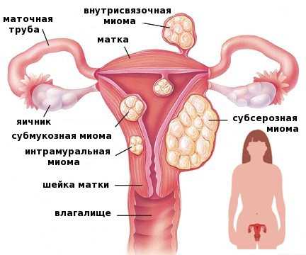 Как проводится гистология матки