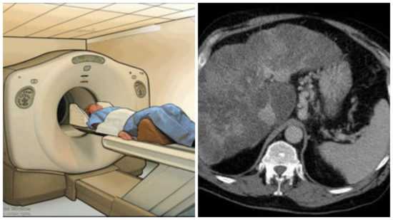 Кт пищевода и желудка. Магнито-резонансная томография желудка. Магниторезонансная томография ЖКТ. Кт брюшной полости опухоль желудка.