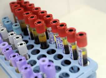 Лимфоциты что показывают в анализе крови