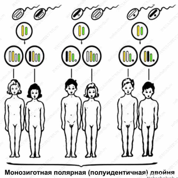 Виды близнецов схема