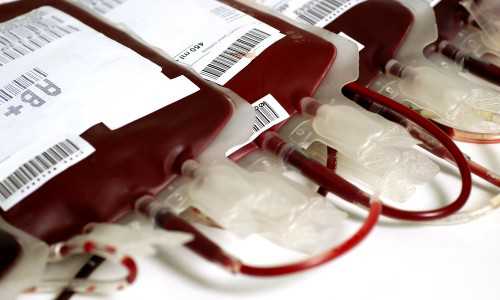 Можно ли завтракать перед сдачей крови на донорство