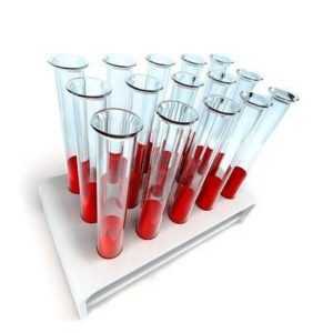 Мснс в анализе крови понижен причины